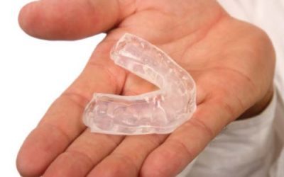 Custom mouth guards prevent concussions!